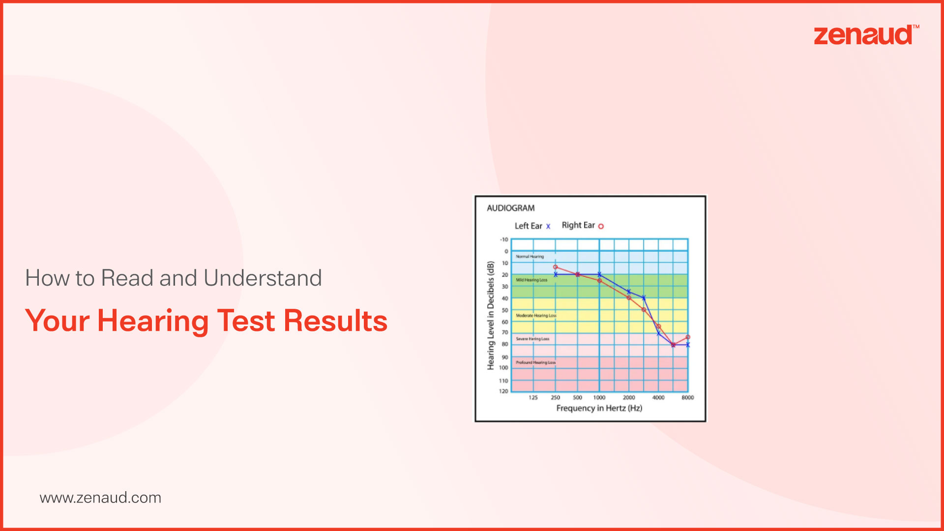 How to Read and Understand Your Hearing Test Results