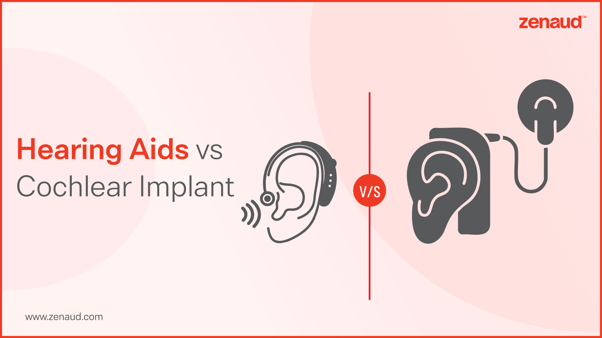 Hearing Aids vs Cochlear Implant